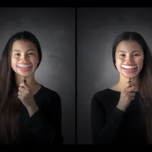 Studioportret van meisje met beugel en zonder beugel, na behandeling bij de orthodontist, Ruden Riemens Fotografie.
