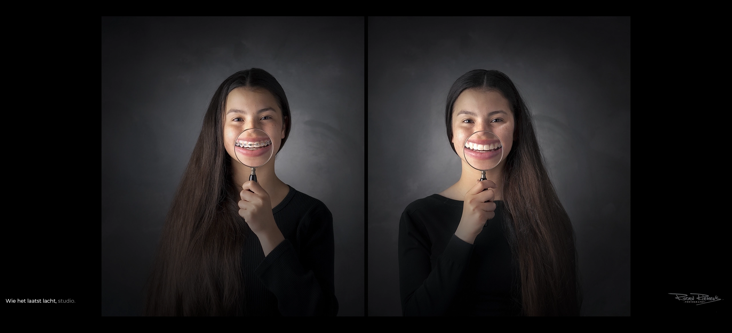 Studioportret van meisje met beugel en zonder beugel, na behandeling bij de orthodontist, Ruden Riemens Fotografie.